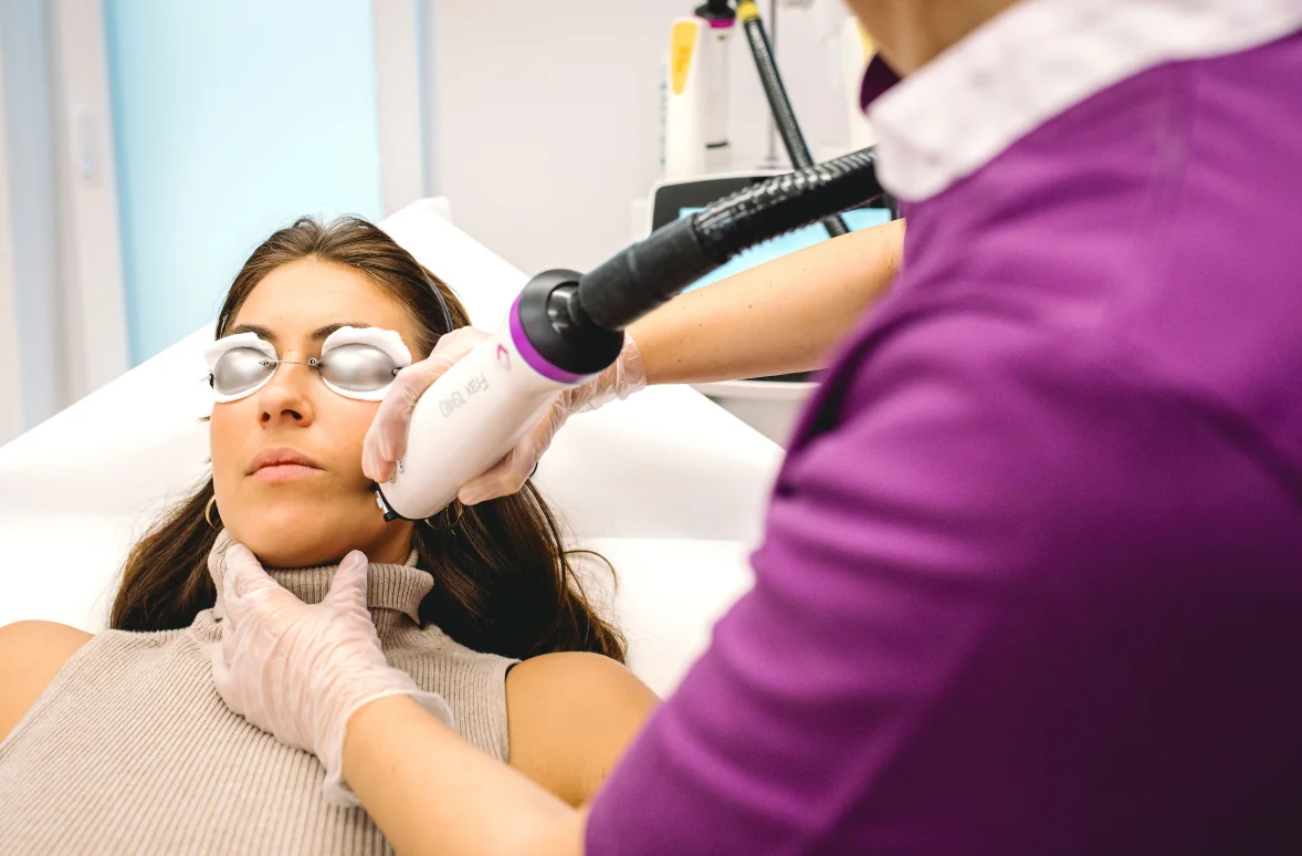 BABY FACE LASERBEHANDLUNG