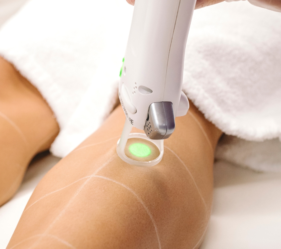 LASER MÉDICAL