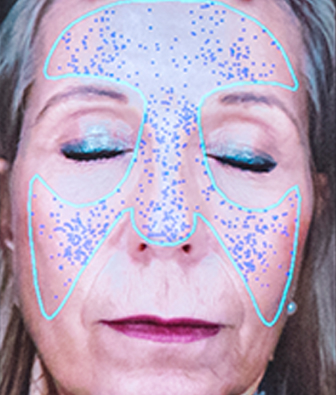 PORES
