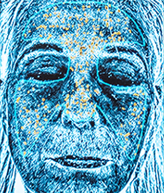 UV SPOTS