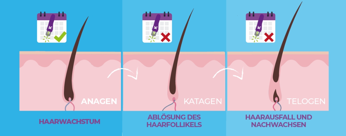 Der Haarwachstumszyklus und seine Bedeutung für die Laser-Haarentfernung