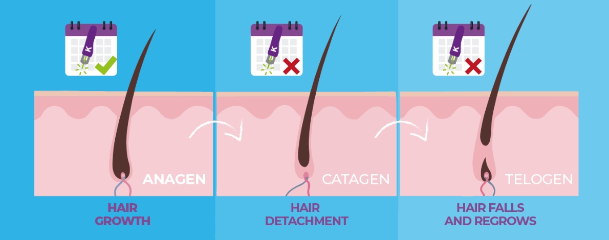 The Hair Growth Cycle and Its Importance for Laser Hair Removal